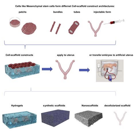 metal uterus fabrication|Biomaterializing the advances in uterine tissue engineering.